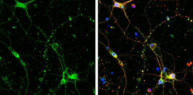 Anti-SHANK3 antibody used in Immunocytochemistry/ Immunofluorescence (ICC/IF). GTX133133