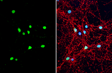Anti-Neuropeptide Y antibody used in Immunocytochemistry/ Immunofluorescence (ICC/IF). GTX133138