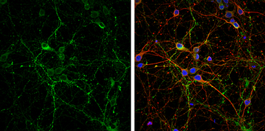 Anti-VGLUT2 antibody used in Immunocytochemistry/ Immunofluorescence (ICC/IF). GTX133142