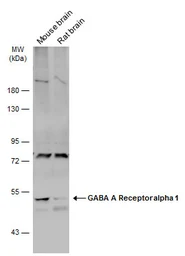 Anti-GABA A Receptor alpha 1 antibody used in Western Blot (WB). GTX133147
