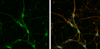 Anti-GABA Transporter 1 / GAT1 antibody used in Immunocytochemistry/ Immunofluorescence (ICC/IF). GTX133150