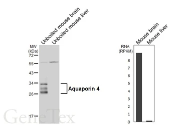 Anti-Aquaporin 4 antibody used in Western Blot (WB). GTX133151
