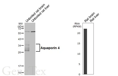 Anti-Aquaporin 4 antibody used in Western Blot (WB). GTX133151