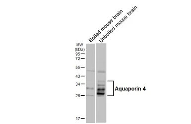 Anti-Aquaporin 4 antibody used in Western Blot (WB). GTX133151