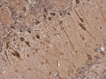 Anti-Dopamine Transporter antibody used in IHC (Paraffin sections) (IHC-P). GTX133152