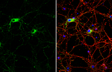 Anti-Somatostatin antibody used in Immunocytochemistry/ Immunofluorescence (ICC/IF). GTX133153
