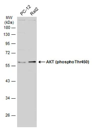 Anti-AKT (phospho Thr450) antibody used in Western Blot (WB). GTX133175