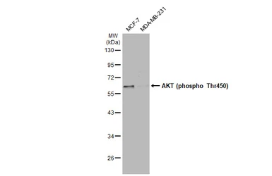 Anti-AKT (phospho Thr450) antibody used in Western Blot (WB). GTX133175