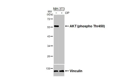 Anti-AKT (phospho Thr450) antibody used in Western Blot (WB). GTX133175