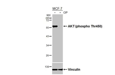 Anti-AKT (phospho Thr450) antibody used in Western Blot (WB). GTX133175