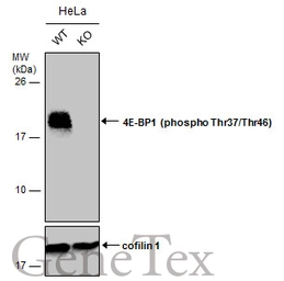 Anti-4E-BP1 (phospho Thr37/Thr46) antibody used in Western Blot (WB). GTX133181