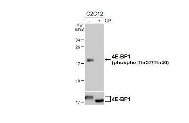 Anti-4E-BP1 (phospho Thr37/Thr46) antibody used in Western Blot (WB). GTX133181