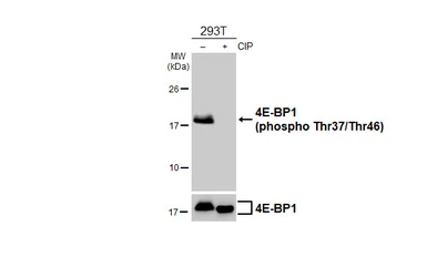 Anti-4E-BP1 (phospho Thr37/Thr46) antibody used in Western Blot (WB). GTX133181