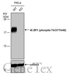 Anti-4E-BP1 (phospho Thr37/Thr46) antibody used in Western Blot (WB). GTX133182