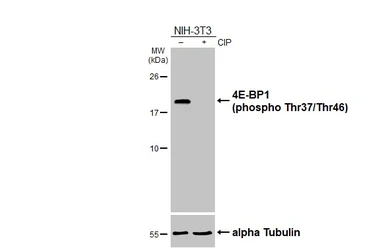 Anti-4E-BP1 (phospho Thr37/Thr46) antibody used in Western Blot (WB). GTX133182