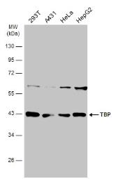 Anti-TBP antibody used in Western Blot (WB). GTX133204