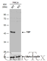 Anti-TBP antibody used in Western Blot (WB). GTX133204