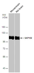 Anti-SAP102 antibody used in Western Blot (WB). GTX133211