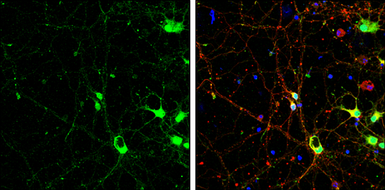 Anti-SAP102 antibody used in Immunocytochemistry/ Immunofluorescence (ICC/IF). GTX133211