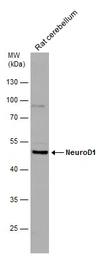 Anti-NeuroD1 antibody used in Western Blot (WB). GTX133214