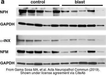 Anti-NF-M antibody used in Western Blot (WB). GTX133215