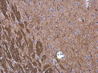 Anti-NF-M antibody used in IHC (Paraffin sections) (IHC-P). GTX133215