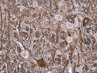 Anti-NF-M antibody used in IHC (Paraffin sections) (IHC-P). GTX133215