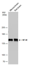 Anti-NF-M antibody used in Western Blot (WB). GTX133218