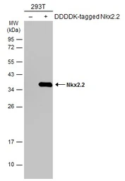 Anti-Nkx2.2 antibody used in Western Blot (WB). GTX133219