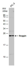 Anti-Noggin antibody used in Western Blot (WB). GTX133222
