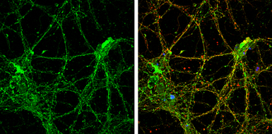Anti-Reelin antibody used in Immunocytochemistry/ Immunofluorescence (ICC/IF). GTX133226