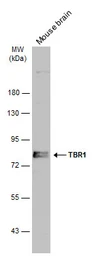 Anti-TBR1 antibody used in Western Blot (WB). GTX133228