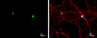 Anti-TBR1 antibody used in Immunocytochemistry/ Immunofluorescence (ICC/IF). GTX133228