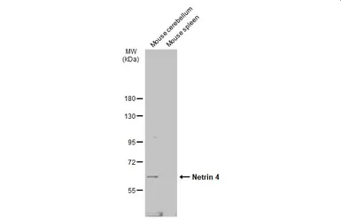 Anti-Netrin 4 antibody used in Western Blot (WB). GTX133230