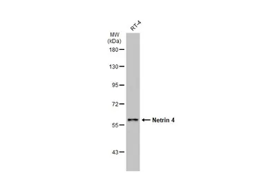 Anti-Netrin 4 antibody used in Western Blot (WB). GTX133230