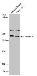 Anti-Plexin A1 antibody used in Western Blot (WB). GTX133240
