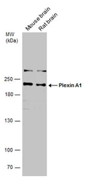 Anti-Plexin A1 antibody used in Western Blot (WB). GTX133240