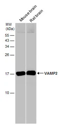 Anti-VAMP2 antibody used in Western Blot (WB). GTX133241