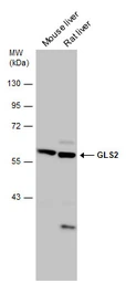 Anti-GLS2 antibody used in Western Blot (WB). GTX133242