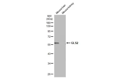 Anti-GLS2 antibody used in Western Blot (WB). GTX133242