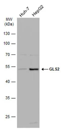 Anti-GLS2 antibody used in Western Blot (WB). GTX133243