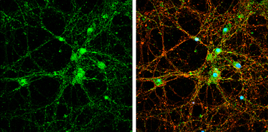 Anti-PSD93 antibody used in Immunocytochemistry/ Immunofluorescence (ICC/IF). GTX133244