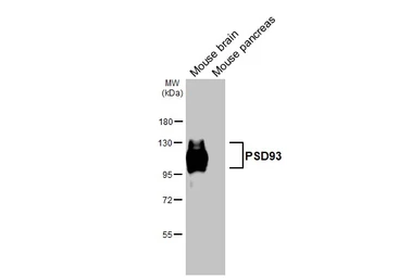 Anti-PSD93 antibody used in Western Blot (WB). GTX133244