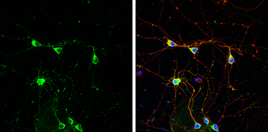 Anti-PSD93 antibody used in Immunocytochemistry/ Immunofluorescence (ICC/IF). GTX133250