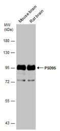 Anti-PSD95 antibody used in Western Blot (WB). GTX133255