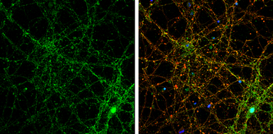 Anti-PSD95 antibody used in Immunocytochemistry/ Immunofluorescence (ICC/IF). GTX133255