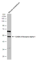 Anti-GABA A Receptor alpha 1 antibody used in Western Blot (WB). GTX133261