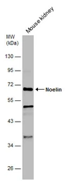 Anti-Noelin antibody used in Western Blot (WB). GTX133262