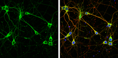 Anti-WAVE1 antibody used in Immunocytochemistry/ Immunofluorescence (ICC/IF). GTX133263