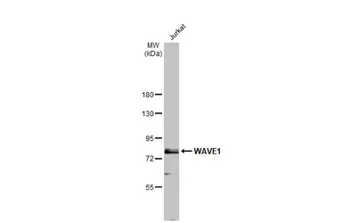 Anti-WAVE1 antibody used in Western Blot (WB). GTX133263